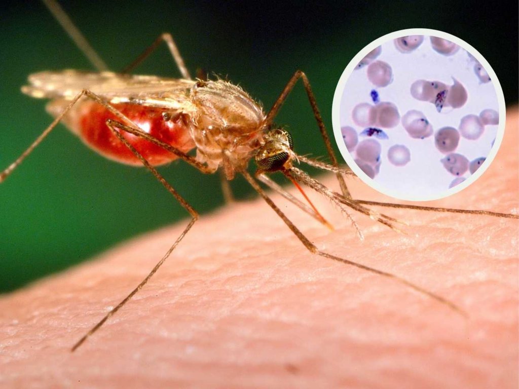 Najgroźniejsze pasożyty na świecie. Pierwsze objawy nawet miesiąc od zarażenia